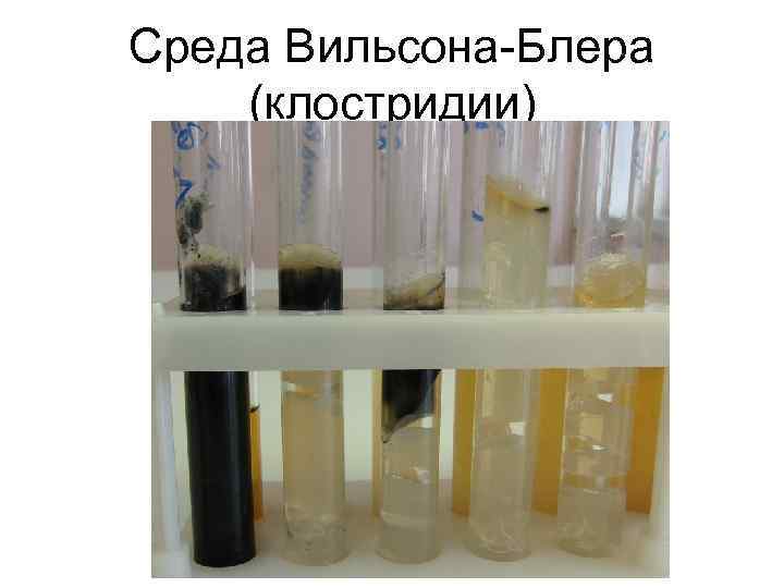 Среда Вильсона Блера (клостридии) 