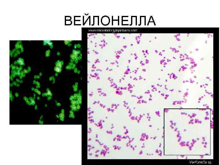 ВЕЙЛОНЕЛЛА 