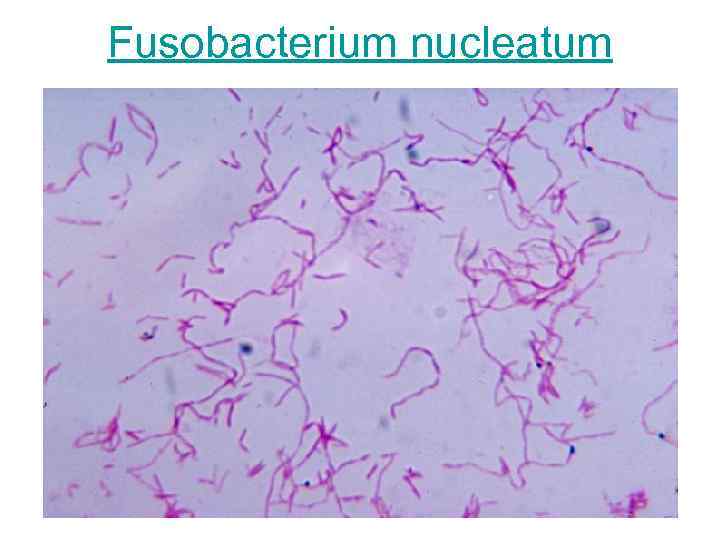 Fusobacterium nucleatum 