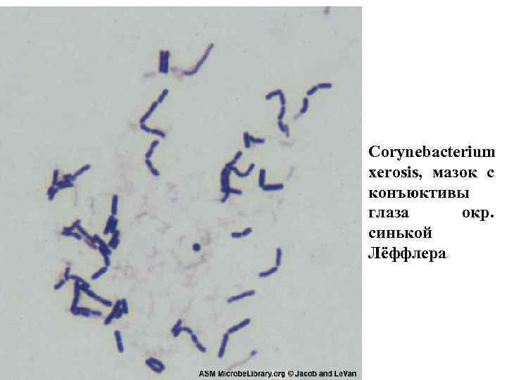 Corynebacterium diphtheriae фото