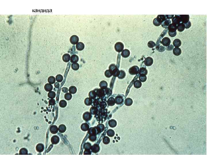 кандида 
