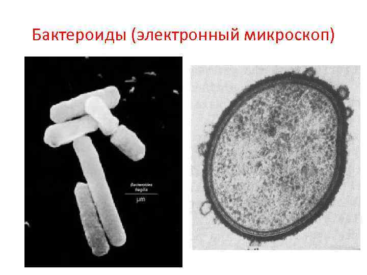 Бактероиды (электронный микроскоп) 