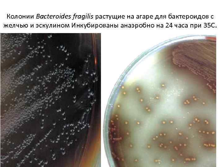 Колонии Bacteroides fragilis растущие на агаре для бактероидов с желчью и эскулином Инкубированы анаэробно