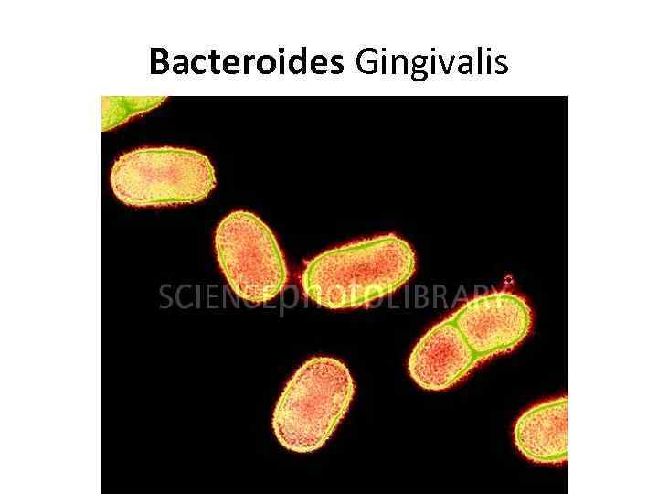 Bacteroides Gingivalis 