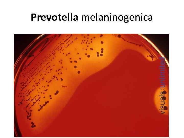 Prevotella melaninogenica 