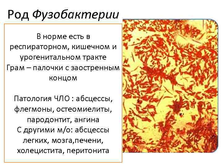 Род Фузобактерии В норме есть в респираторном, кишечном и урогенитальном тракте Грам – палочки