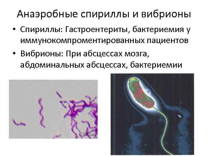 Анаэробные спириллы и вибрионы • Спириллы: Гастроентериты, бактериемия у иммунокомпроментированных пациентов • Вибрионы: При