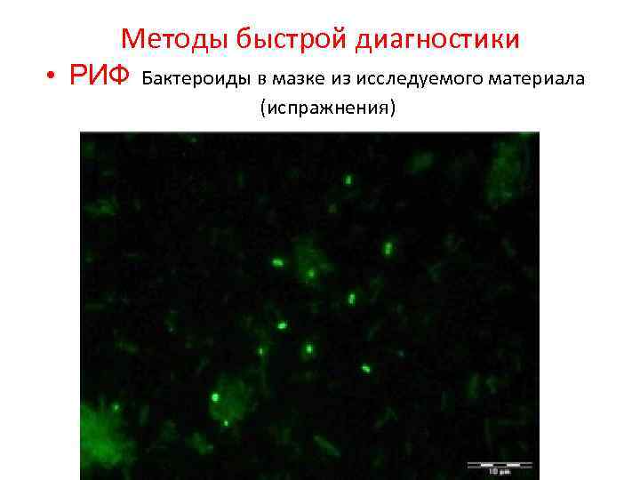 Методы быстрой диагностики • РИФ Бактероиды в мазке из исследуемого материала (испражнения) 