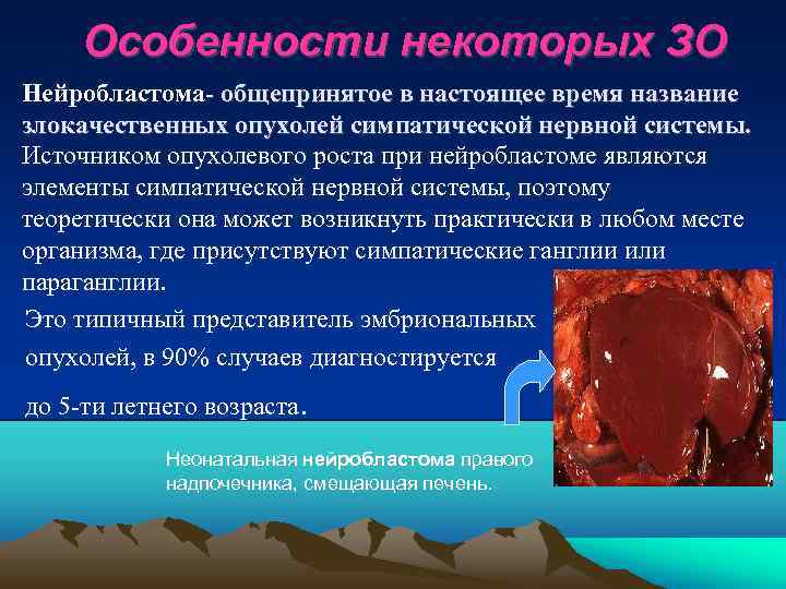 Особенности некоторых ЗО • Нейробластома- общепринятое в настоящее время название злокачественных опухолей симпатической нервной