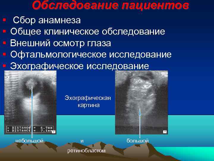 Обследование пациентов Сбор анамнеза Общее клиническое обследование Внешний осмотр глаза Офтальмологическое исследование Эхографическое исследование