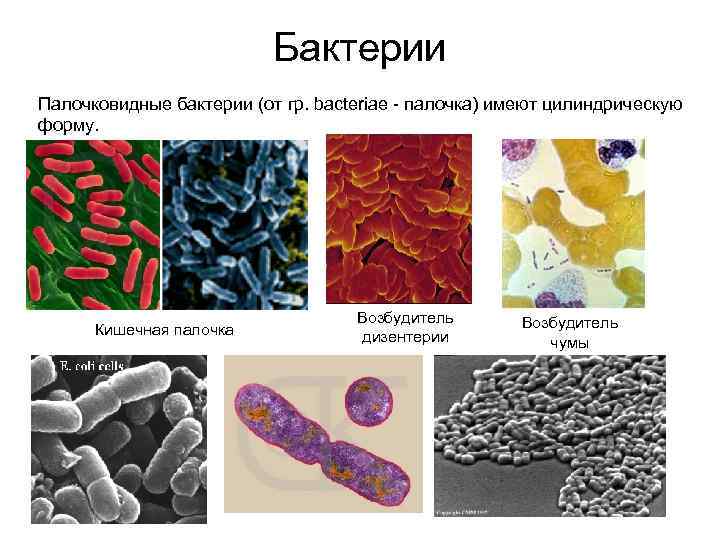 Бактерии Палочковидные бактерии (от гр. bacteriae - палочка) имеют цилиндрическую форму. Кишечная палочка Возбудитель