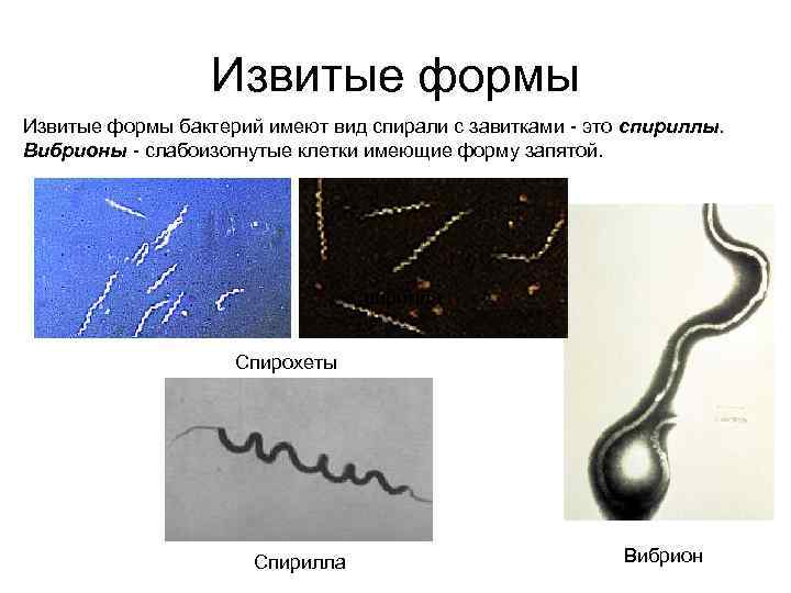 Извитые формы бактерий имеют вид спирали с завитками - это спириллы. Вибрионы - слабоизогнутые