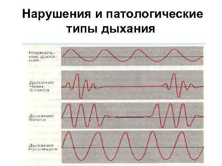 Нарушения и патологические типы дыхания 