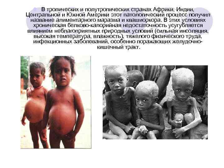 l В тропических и полутропических странах Африки, Индии, Центральной и Южной Америки этот патологический