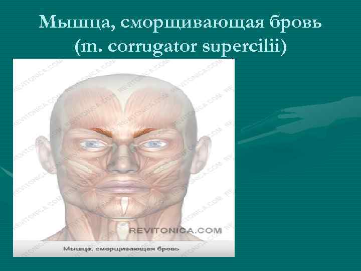 Мышца, сморщивающая бровь (m. corrugator supercilii) 