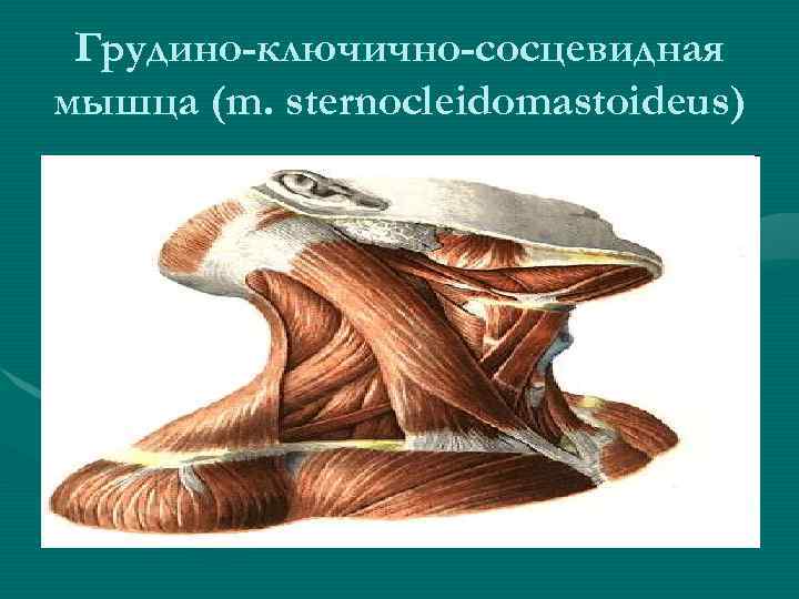 Грудино-ключично-сосцевидная мышца (m. sternocleidomastoideus) 