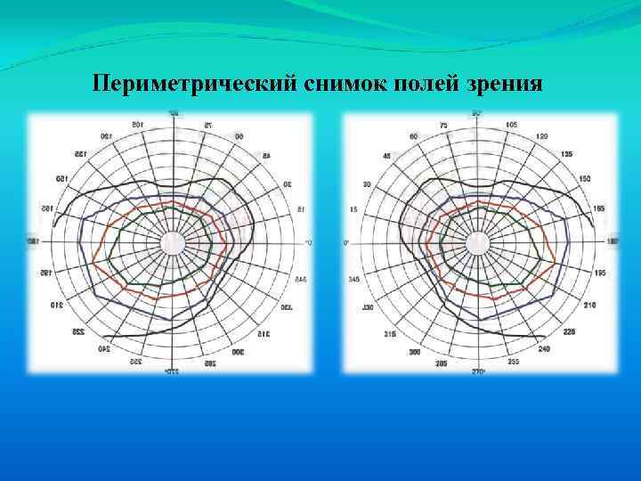 Границы поля зрения. Периметрический снимок полей зрения. Периметрический бланк для определения полей зрения. Обнаружение борьбы полей зрения. Периметрический график зрения.