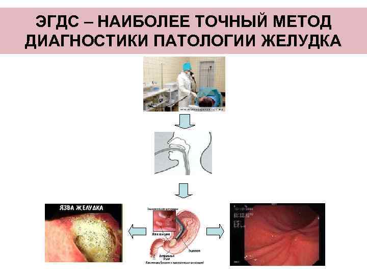 ПРОМЫВАНИЕ ЖЕЛУДКА – ПЕРВАЯ  ПОМОЩЬ ПРИ ОТРАВЛЕНИИ 