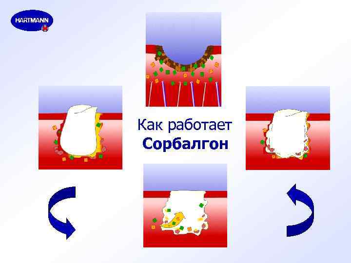 Как работает Сорбалгон 