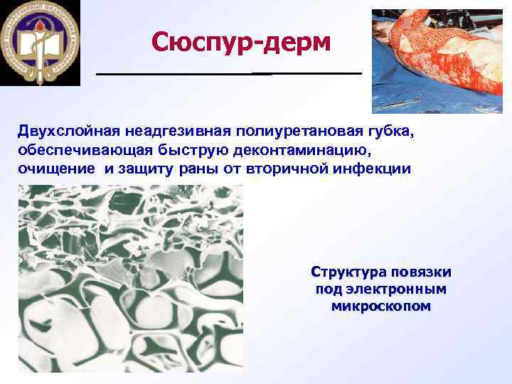 Сюспур-дерм Двухслойная неадгезивная полиуретановая губка, обеспечивающая быструю деконтаминацию, очищение и защиту раны от вторичной