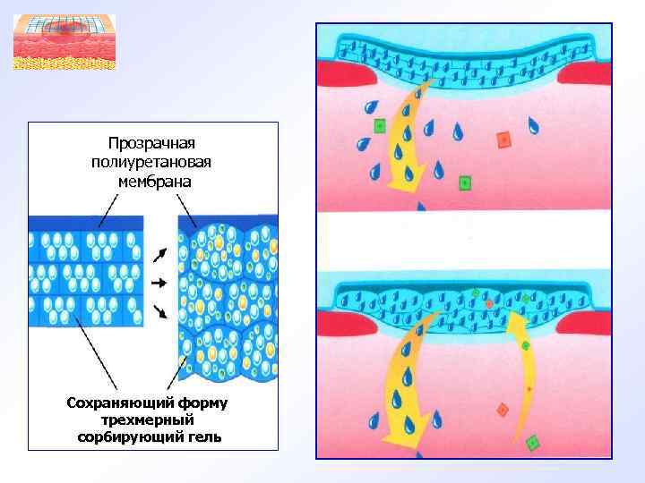 Прозрачная полиуретановая мембрана Сохраняющий форму трехмерный сорбирующий гель 