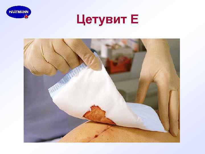 Цетувит Е 