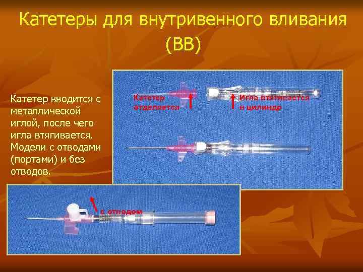 Катетеры для внутривенного вливания (ВВ) Катетер вводится с металлической иглой, после чего игла втягивается.
