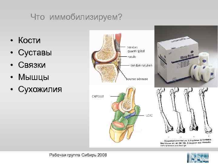 Что иммобилизируем? • • • Кости Суставы Связки Мышцы Сухожилия Рабочая группа Сибирь 2008