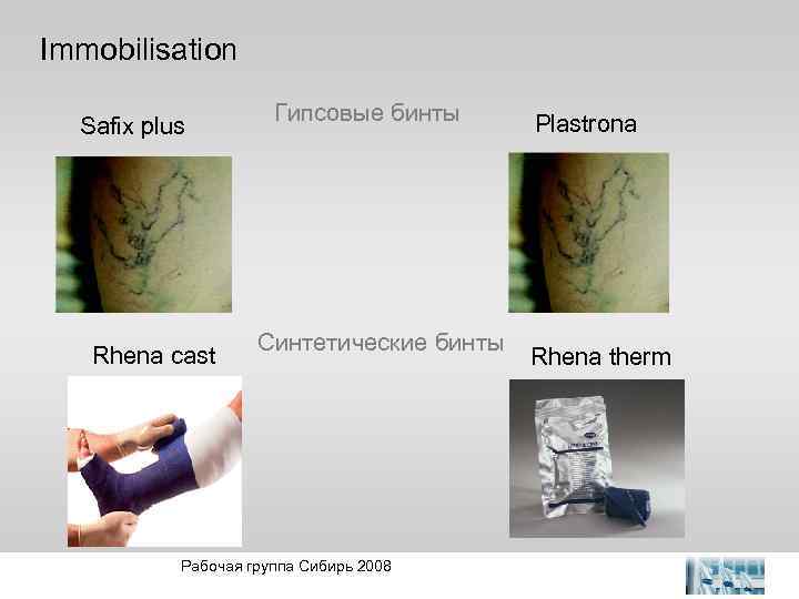 Immobilisation Safix plus Rhena cast 25. Mai 2004 Гипсовые бинты Синтетические бинты Рабочая группа