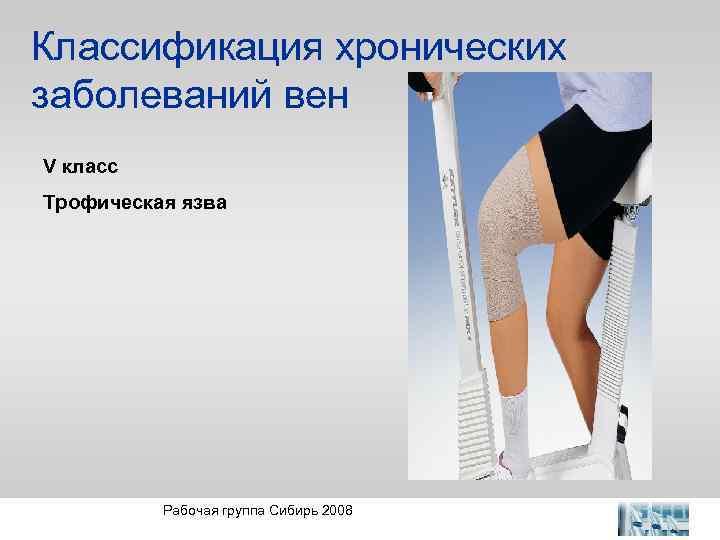 Классификация хронических заболеваний вен V класс Трофическая язва Рабочая группа Сибирь 2008 