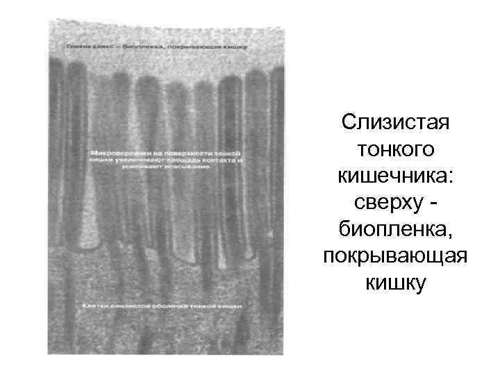 Слизистая тонкого кишечника: сверху - биопленка, покрывающая кишку 