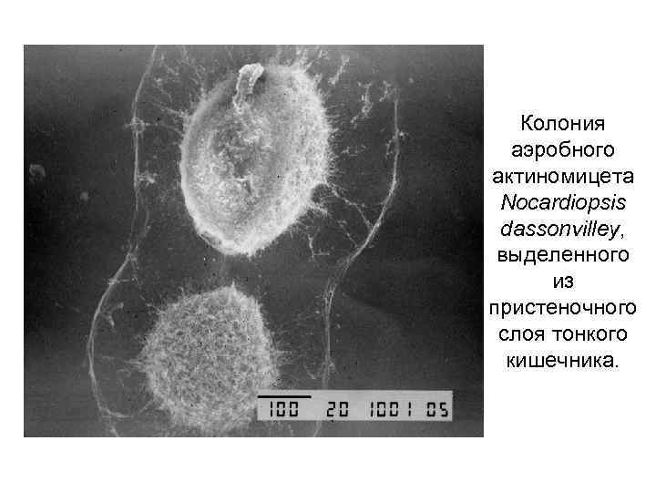 Колония аэробного актиномицета Nocardiopsis dassonvilley, выделенного из пристеночного слоя тонкого кишечника. 