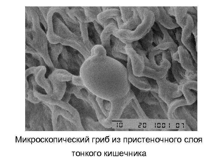 Микроскопический гриб из пристеночного слоя тонкого кишечника 