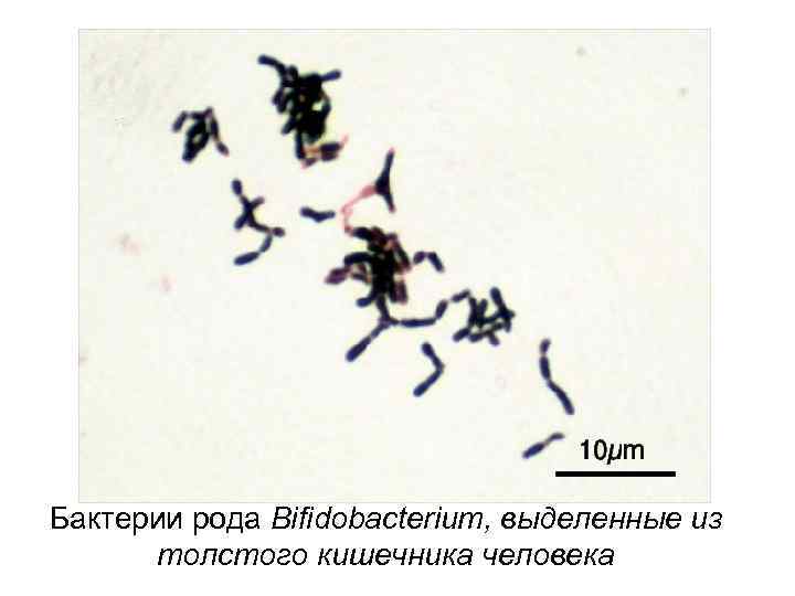 Бактерии рода Bifidobacterium, выделенные из толстого кишечника человека 