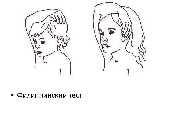  • Филиппинский тест 
