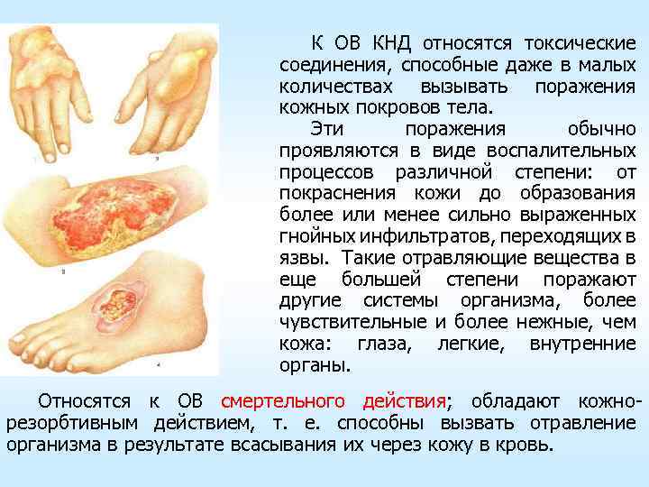 К ОВ КНД относятся токсические соединения, способные даже в малых количествах вызывать поражения кожных