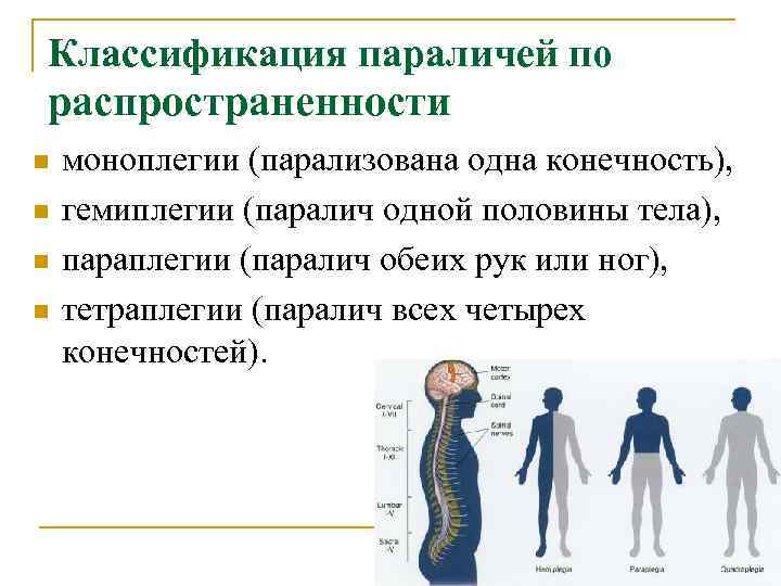 Классификация параличей по распространенности n моноплегии (парализована одна конечность), n гемиплегии (паралич одной половины