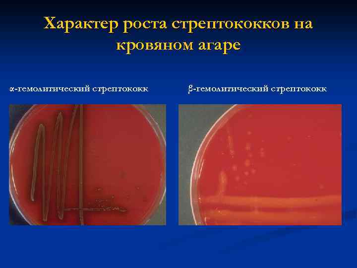 Характер роста стрептококков на кровяном агаре α-гемолитический стрептококк β-гемолитический стрептококк 