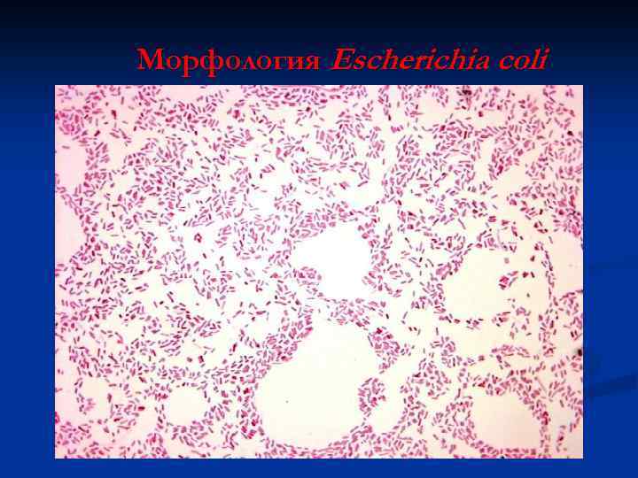 Морфология Escherichia coli 