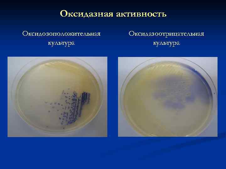 Оксидазная активность Оксидозоположительная культура Оксидазоотрицательная культура 