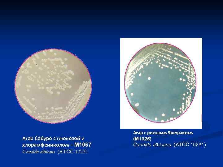 Агар Сабуро с глюкозой и хлорамфениколом – M 1067 Candida albicans (ATCC 10231 Агар