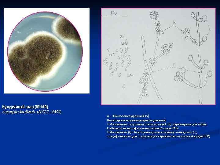 Кукурузный агар (M 146) Aspergillus brasiliensis (ATCC 16404) А : Почкование дрожжей (y) На