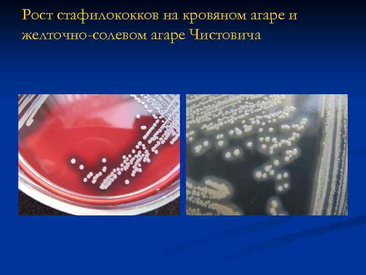 Рост стафилококков на кровяном агаре и желточно-солевом агаре Чистовича 