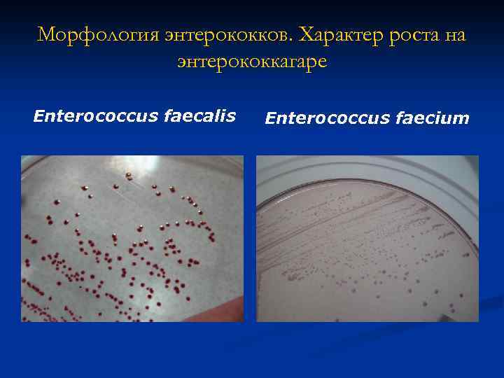 Морфология энтерококков. Характер роста на энтерококкагаре Enterococcus faecalis Enterococcus faecium 
