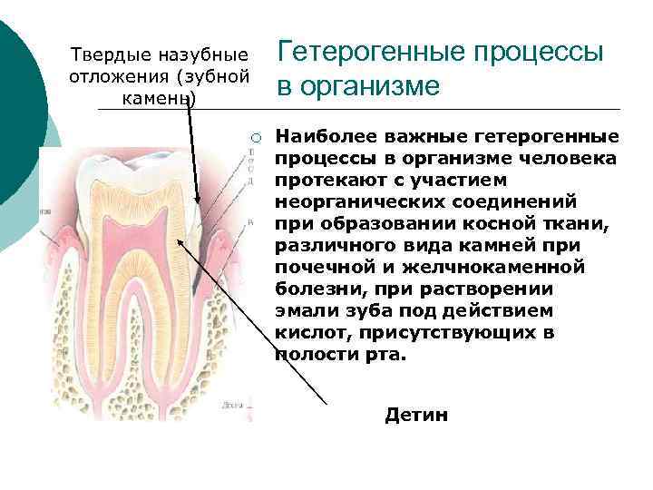 Гетерогенные процессы в организме Твердые назубные отложения (зубной камень) ¡ Наиболее важные гетерогенные процессы