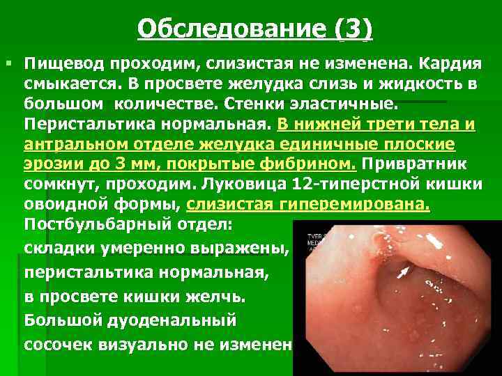 Обследование (3) § Пищевод проходим, слизистая не изменена. Кардия смыкается. В просвете желудка слизь