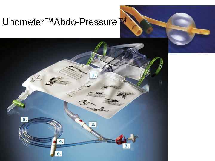 Unometer™Abdo-Pressure™ 