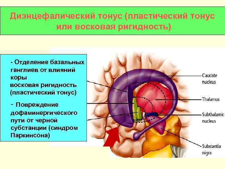 Диэнцефалический тонус (пластический тонус или восковая ригидность) - Отделение базальных ганглиев от влияний коры
