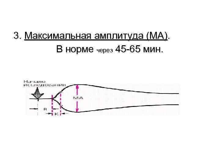 3. Максимальная амплитуда (МА). В норме через 45 -65 мин. 