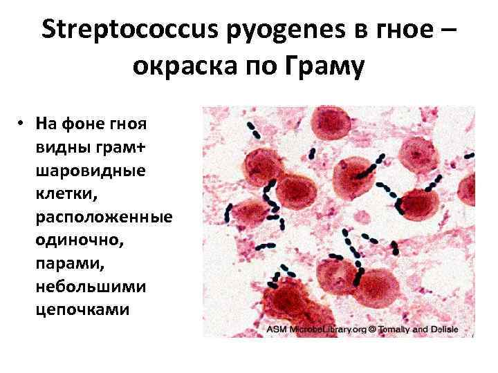 Streptococcus pyogenes в гное – окраска по Граму • На фоне гноя видны грам+